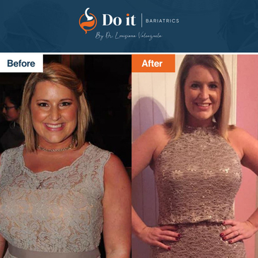 Slider image (3) Do It Bariatrics